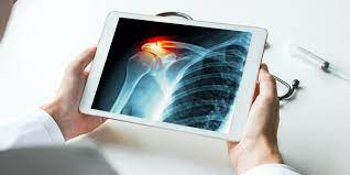 Digital X-Ray Digital X-Ray