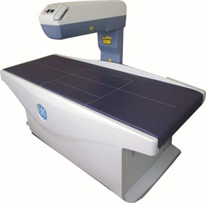 DEXA Scan